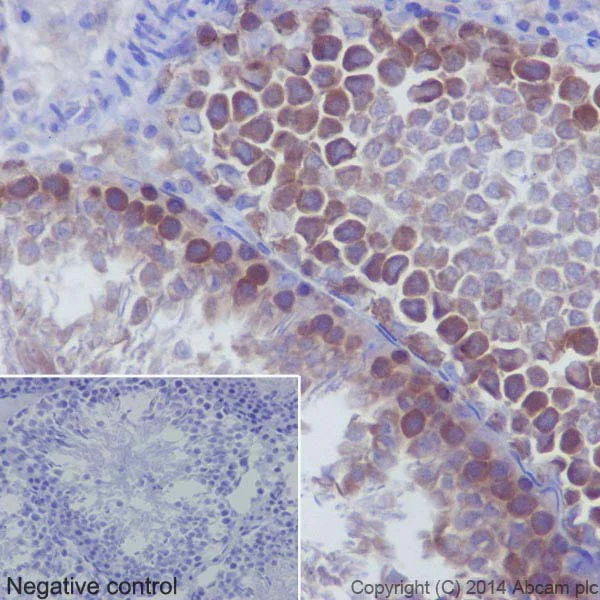 Immunohistochemistry (Formalin/PFA-fixed paraffin-embedded sections) - Anti-gamma Tubulin antibody [EPR16793] - BSA and Azide free (AB240216)