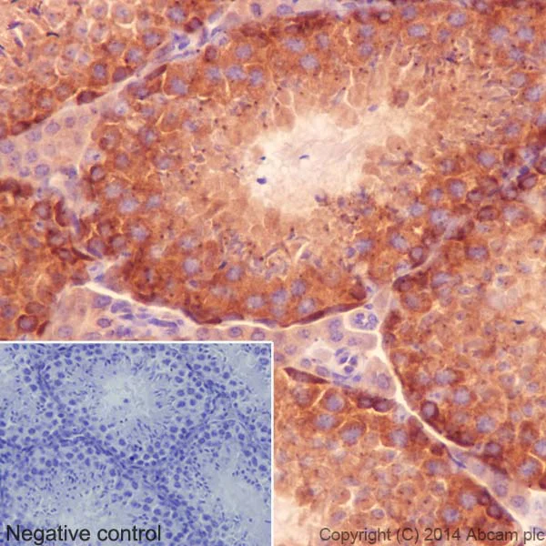 Immunohistochemistry (Formalin/PFA-fixed paraffin-embedded sections) - Anti-gamma Tubulin antibody [EPR16793] - Centrosome Marker (AB179503)