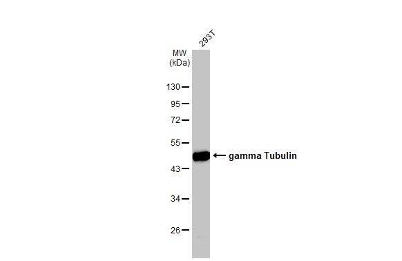 Western blot - Anti-gamma Tubulin antibody [HL1175] (AB308382), expandable thumbnail