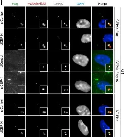 Immunocytochemistry/ Immunofluorescence - Anti-gamma Tubulin antibody [TU-30] - Centrosome Marker (AB27074)