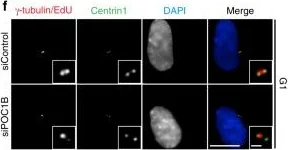 Immunocytochemistry/ Immunofluorescence - Anti-gamma Tubulin antibody [TU-30] - Centrosome Marker (AB27074)
