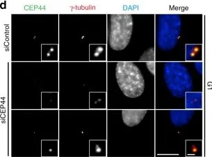 Immunocytochemistry/ Immunofluorescence - Anti-gamma Tubulin antibody [TU-30] - Centrosome Marker (AB27074)