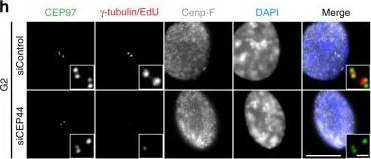 Immunocytochemistry/ Immunofluorescence - Anti-gamma Tubulin antibody [TU-30] - Centrosome Marker (AB27074)