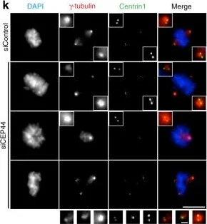 Immunocytochemistry/ Immunofluorescence - Anti-gamma Tubulin antibody [TU-30] - Centrosome Marker (AB27074)