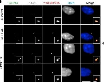 Immunocytochemistry/ Immunofluorescence - Anti-gamma Tubulin antibody [TU-30] - Centrosome Marker (AB27074)