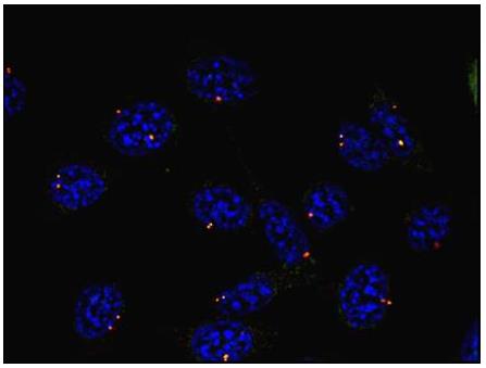 Immunocytochemistry/ Immunofluorescence - Anti-gamma Tubulin antibody [TU-30] - Centrosome Marker (AB27074), expandable thumbnail
