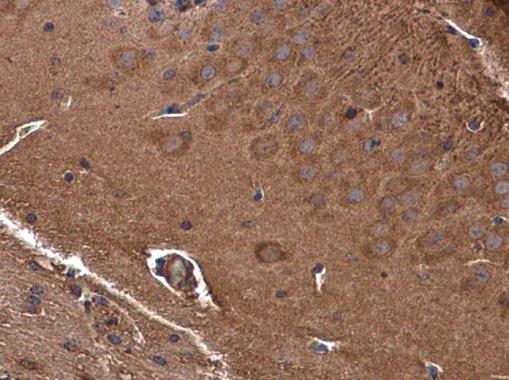 Immunohistochemistry (Formalin/PFA-fixed paraffin-embedded sections) - Anti-GAMT antibody (AB229467)