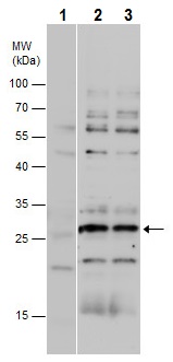 Western blot - Anti-GAMT antibody (AB229467)