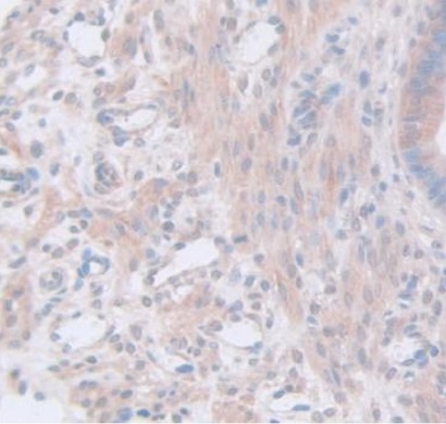 Immunohistochemistry (Formalin/PFA-fixed paraffin-embedded sections) - Anti-GAMT antibody (AB231656), expandable thumbnail
