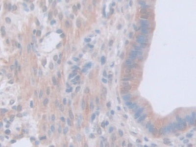 Immunohistochemistry (Formalin/PFA-fixed paraffin-embedded sections) - Anti-GAMT antibody (AB231656), expandable thumbnail
