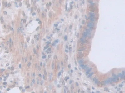 Immunohistochemistry (Formalin/PFA-fixed paraffin-embedded sections) - Anti-GAMT antibody (AB231656)