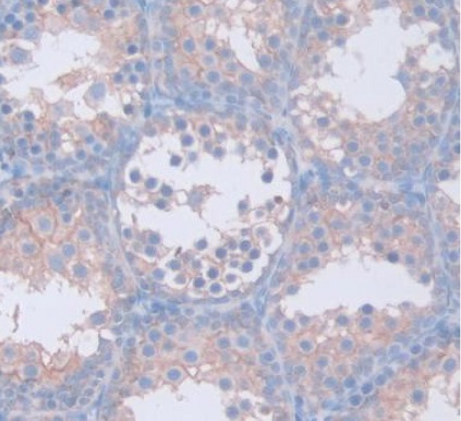 Immunohistochemistry (Formalin/PFA-fixed paraffin-embedded sections) - Anti-GAMT antibody (AB231656), expandable thumbnail
