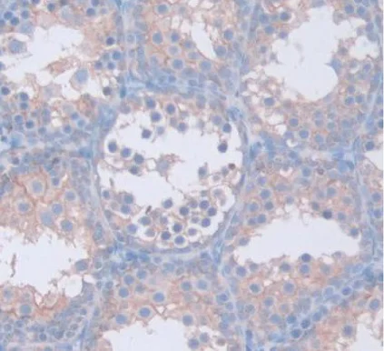 Immunohistochemistry (Formalin/PFA-fixed paraffin-embedded sections) - Anti-GAMT antibody (AB231656)
