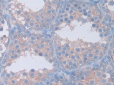 Immunohistochemistry (Formalin/PFA-fixed paraffin-embedded sections) - Anti-GAMT antibody (ab231656), expandable thumbnail