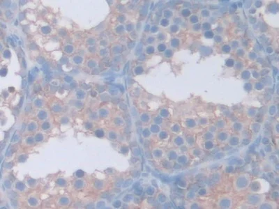 Immunohistochemistry (Formalin/PFA-fixed paraffin-embedded sections) - Anti-GAMT antibody (AB231656)