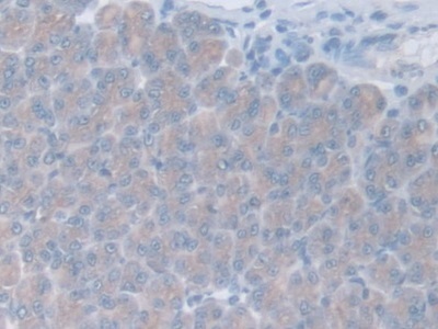 Immunohistochemistry (Formalin/PFA-fixed paraffin-embedded sections) - Anti-GAMT antibody (ab231656), expandable thumbnail