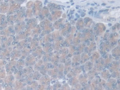 Immunohistochemistry (Formalin/PFA-fixed paraffin-embedded sections) - Anti-GAMT antibody (AB231656)