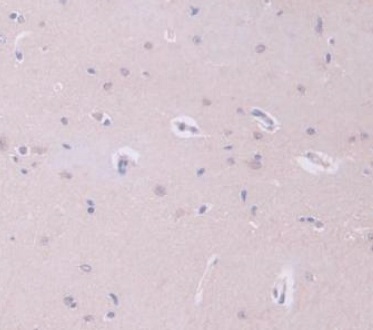 Immunohistochemistry (Formalin/PFA-fixed paraffin-embedded sections) - Anti-GAMT antibody (AB231656), expandable thumbnail