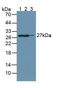 Western blot - Anti-GAMT antibody (AB231656)
