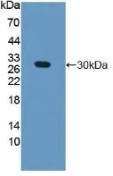Western blot - Anti-GAMT antibody (AB231656)