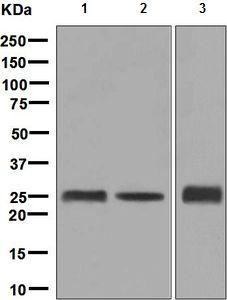 Western blot - Anti-GAMT antibody [EPR6924] (AB128918), expandable thumbnail