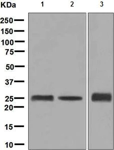 Western blot - Anti-GAMT antibody [EPR6924] (AB128918)