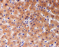 Immunohistochemistry (Formalin/PFA-fixed paraffin-embedded sections) - Anti-GAMT antibody [EPR6925] (AB126736), expandable thumbnail