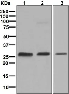 Western blot - Anti-GAMT antibody [EPR6925] - BSA and Azide free (AB248155)