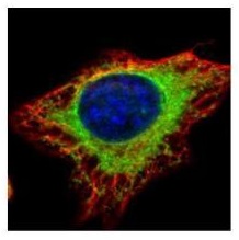Immunocytochemistry/ Immunofluorescence - Anti-GANAB antibody (AB96757)