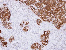 Immunohistochemistry (Formalin/PFA-fixed paraffin-embedded sections) - Anti-GANAB antibody (AB96757)