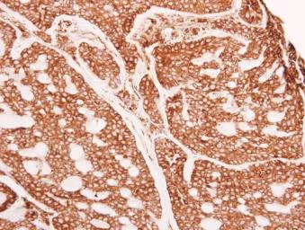 Immunohistochemistry (Formalin/PFA-fixed paraffin-embedded sections) - Anti-GANAB antibody (AB96757)