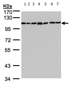 Western blot - Anti-GANAB antibody (AB96757)