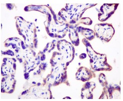 Immunohistochemistry (Formalin/PFA-fixed paraffin-embedded sections) - Anti-GANAB antibody [EPR12376] (AB176349)
