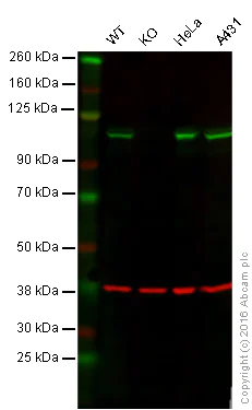 Western blot - Anti-GANAB antibody [EPR12376] (AB176349)
