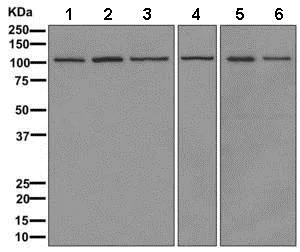 Western blot - Anti-GANAB antibody [EPR12377(B)] (AB179805)