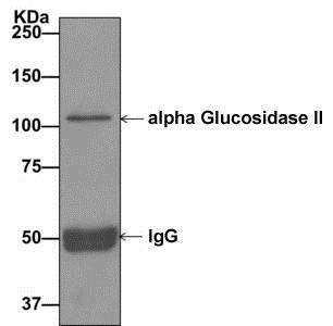 Immunoprecipitation - Anti-GANAB antibody [EPR12377(B)] - BSA and Azide free (AB250111), expandable thumbnail