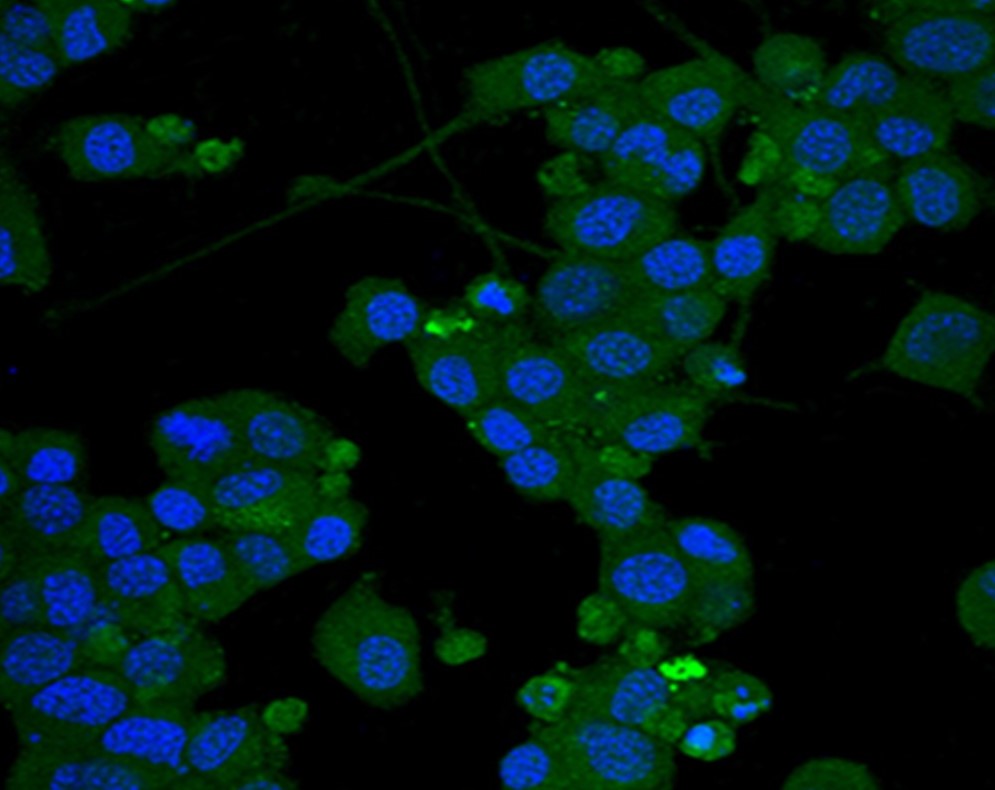 Immunocytochemistry/ Immunofluorescence - Anti-Ganglioside GD2 antibody [14.G2a] (AB68456)