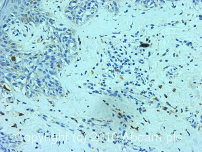 Immunohistochemistry (Formalin/PFA-fixed paraffin-embedded sections) - Anti-Ganglioside GD3 antibody [R24] (AB11779)
