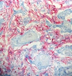 Immunohistochemistry (Frozen sections) - Anti-Ganglioside GD3 antibody [R24] (AB11779)