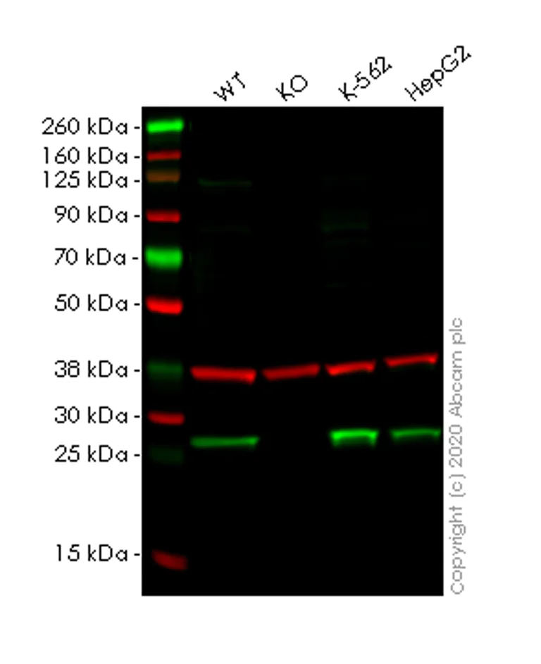 Western blot - Anti-Gankyrin antibody [EPR14455] (AB182576)