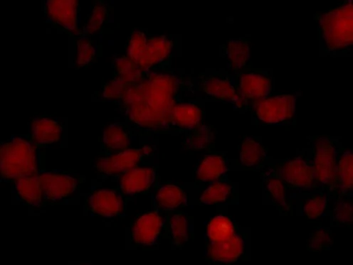 Immunocytochemistry/ Immunofluorescence - Anti-Gankyrin antibody [EPR14455] - BSA and Azide free (AB238999)
