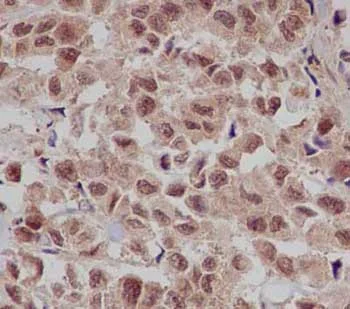 Immunohistochemistry (Formalin/PFA-fixed paraffin-embedded sections) - Anti-Gankyrin antibody [EPR14455] - BSA and Azide free (AB238999)