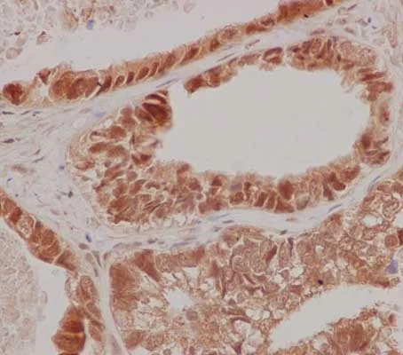 Immunohistochemistry (Formalin/PFA-fixed paraffin-embedded sections) - Anti-Gankyrin antibody [EPR14455] - BSA and Azide free (AB238999)