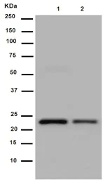 Western blot - Anti-Gankyrin antibody [EPR14456(2)] (AB188315)