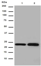 Western blot - Anti-Gankyrin antibody [EPR14456(2)] (AB188315)