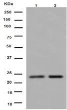 Western blot - Anti-Gankyrin antibody [EPR14456(2)] (AB188315)