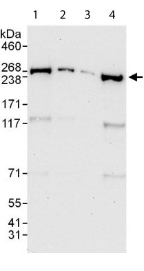 Western blot - Anti-GANP antibody (AB113295)