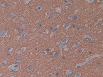 Immunohistochemistry (Formalin/PFA-fixed paraffin-embedded sections) - Anti-GAP43 antibody (AB232772), expandable thumbnail