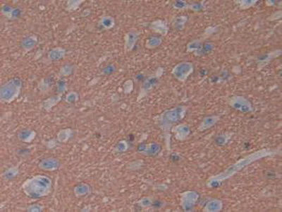 Immunohistochemistry (Formalin/PFA-fixed paraffin-embedded sections) - Anti-GAP43 antibody (AB232772)
