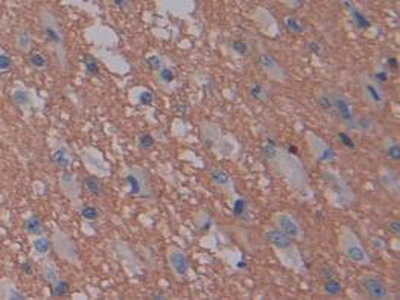 Immunohistochemistry (Formalin/PFA-fixed paraffin-embedded sections) - Anti-GAP43 antibody (AB232772), expandable thumbnail